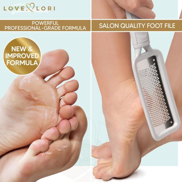 LOVE, LORI Foot Scrubber File & Callus Remover Gel Bundle - Feet Scrubber Dead Skin - Foot Spa Kit - Image 3